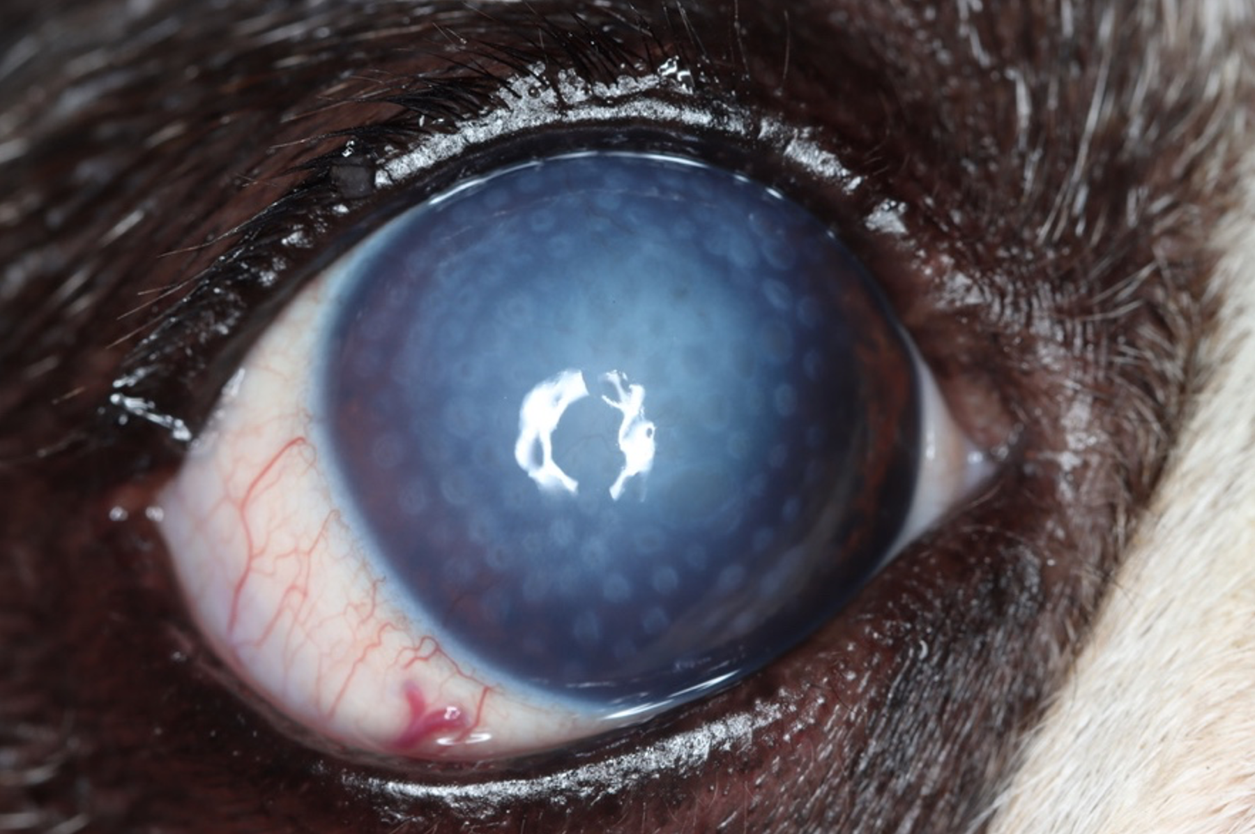 An eye that has recently undergone thermokeratoplasty. Note that it is now open and comfortable, but the cornea remains cloudy.