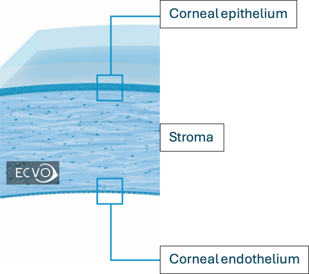 Corneal Endothelial Degeneration