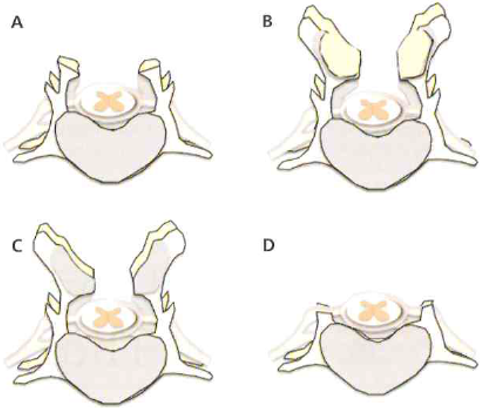 ventral slot