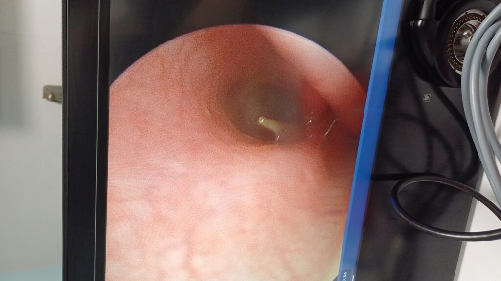 CT scan at South East Vet Referrals showing a grass seed foreign body in the nose of a dog (chihuahua)